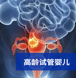 高龄试管婴儿技术
