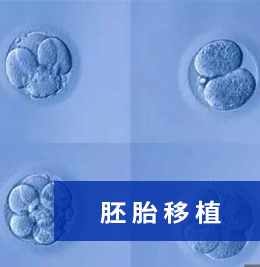 胚胎移植技术